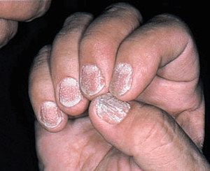 15. 鉄分のサプリメントを検討する