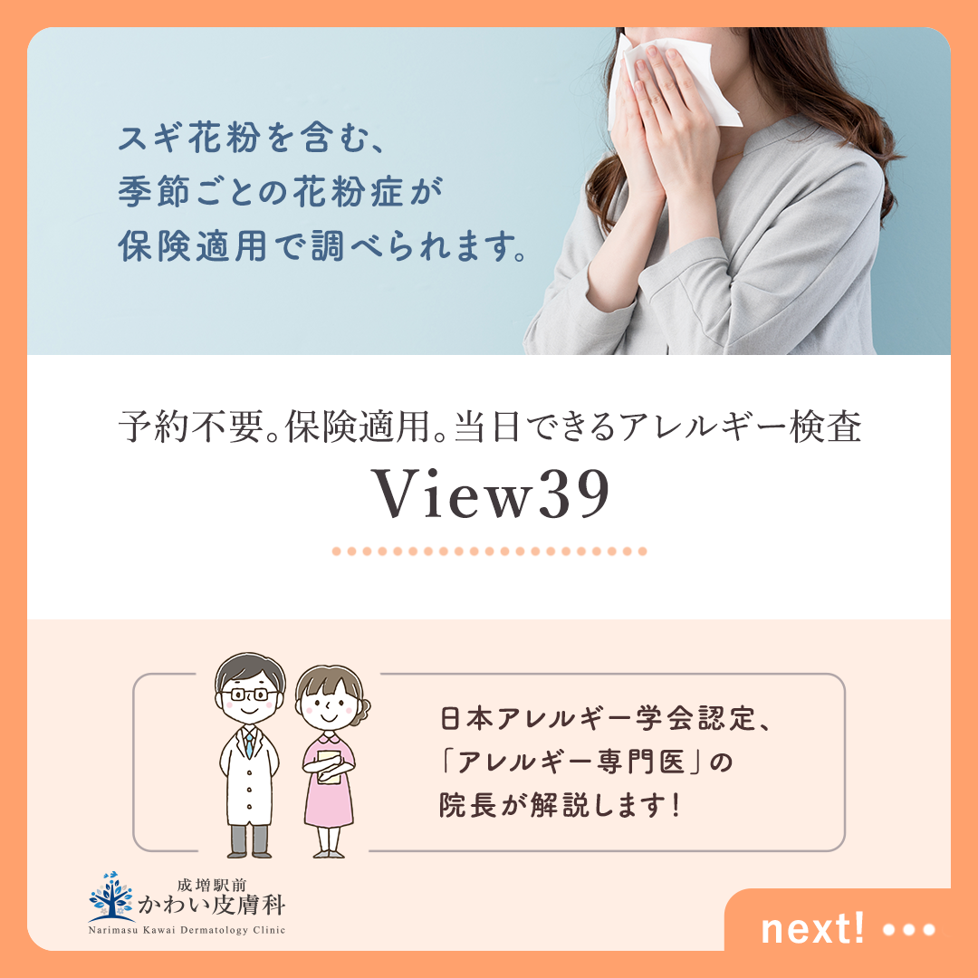 予約不要・保険適用のアレルギー検査～View39 - 板橋区成増駅前