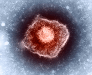 水痘（水ぼうそう）の原因：水痘・帯状疱疹ウイルス