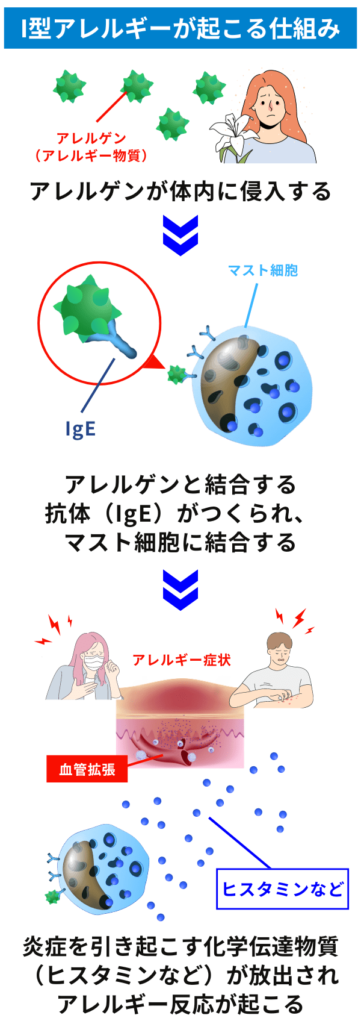 I型（即時型）アレルギーが起こる仕組み