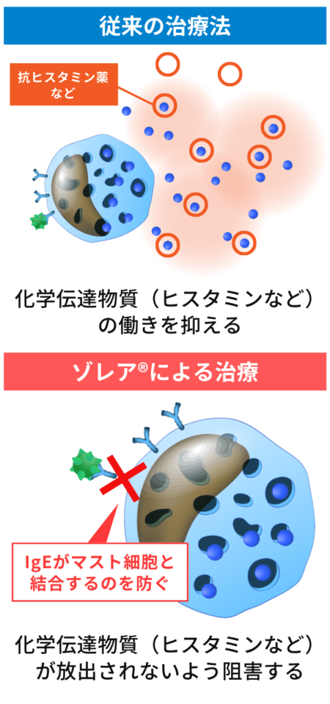 ゾレア®（オマリズマブ）と従来治療薬との違い