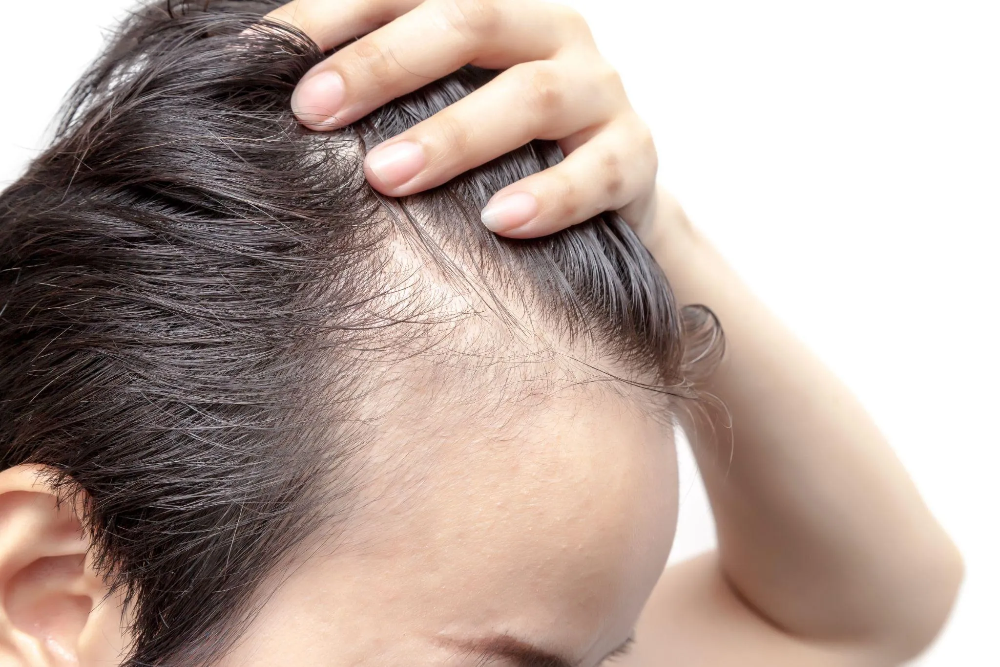 薄毛予防に効果的な対策とは？症状や開始時期も紹介