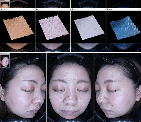 NeoVoir Ⅰ PLUS（ネオヴォワールワンプラス）：「本当の肌」が分かる3D画像と高画質撮影