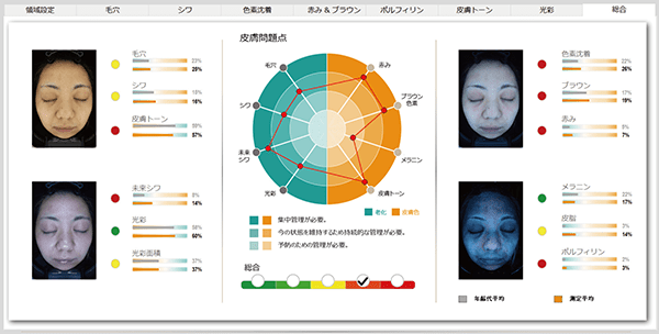 NeoVoir Ⅰ PLUS（ネオヴォワールワンプラス）：総合評価2