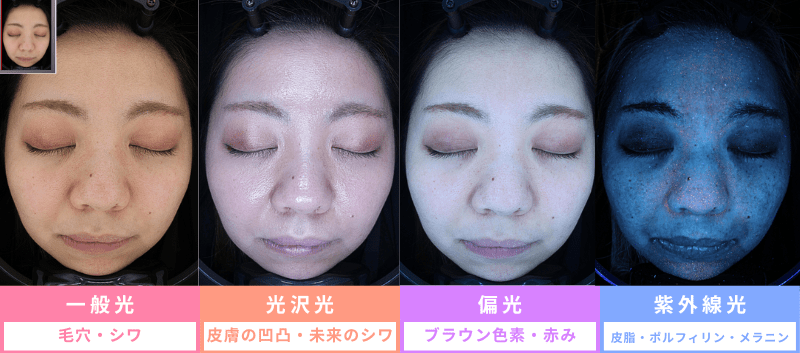 NeoVoir Ⅰ PLUS（ネオヴォワールワンプラス）4つのLED光源であらゆる肌悩みが測定可能に