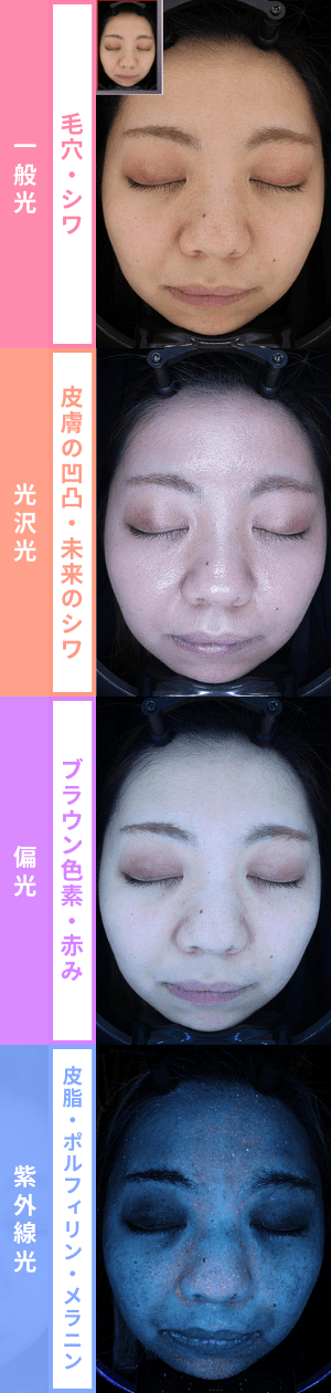 NeoVoir Ⅰ PLUS（ネオヴォワールワンプラス）4つのLED光源であらゆる肌悩みが測定可能に