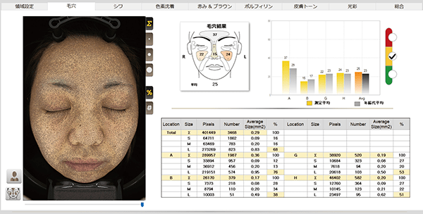 NeoVoir Ⅰ PLUS（ネオヴォワールワンプラス）：分析結果：毛穴