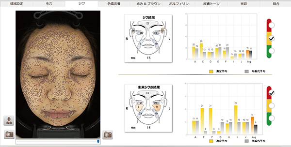 NeoVoir Ⅰ PLUS（ネオヴォワールワンプラス）：分析結果：シワ