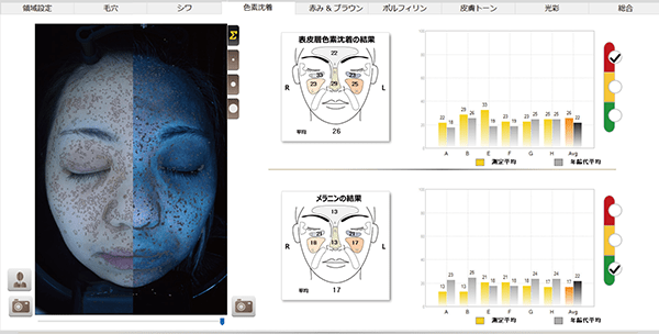 NeoVoir Ⅰ PLUS（ネオヴォワールワンプラス）：分析結果：色素沈着・シミ