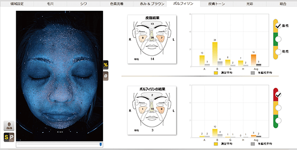 NeoVoir Ⅰ PLUS（ネオヴォワールワンプラス）：分析結果：皮脂・ポルフィリン