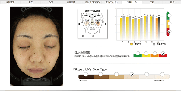 NeoVoir Ⅰ PLUS（ネオヴォワールワンプラス）：分析結果：皮膚トーン・目の下のクマ