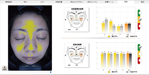 NeoVoir Ⅰ PLUS（ネオヴォワールワンプラス）：分析結果：光彩（皮膚の凹凸）