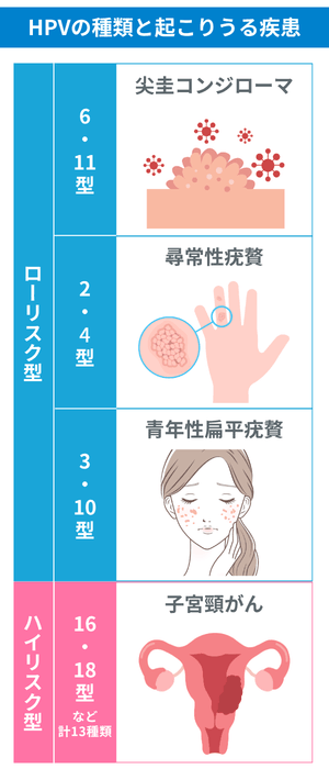 ヒトパピローマウイルス（HPV）の種類と起こりうる疾患