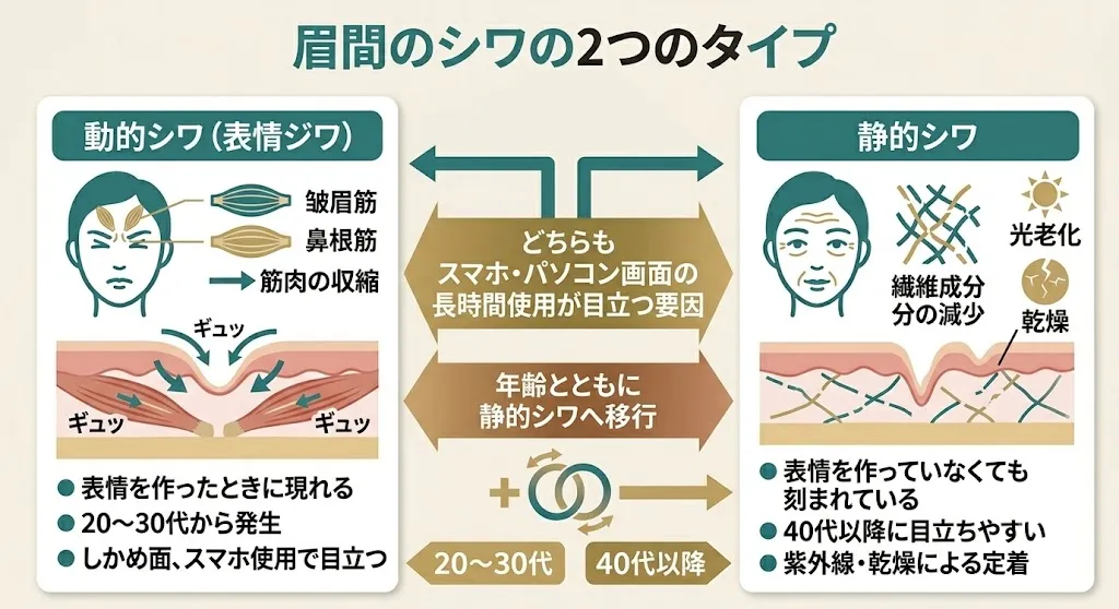 眉間のシワには2種類ある|「動的シワ」と「静的シワ」の違い