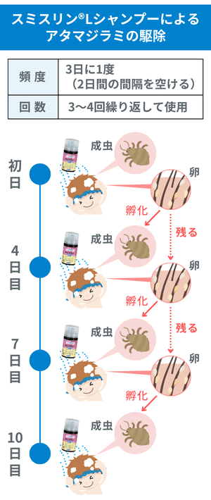 アタマジラミの治療:フェノトリン製剤を10日ほど繰り返す理由